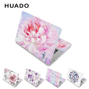 Flower Laptop Skin Decal Notebook Sticker 13 15 15.6 inch Laptop Skin for Lenovo/Xiaomi/Macbook/Asus